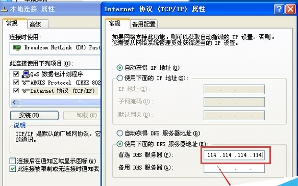 本地连接属性