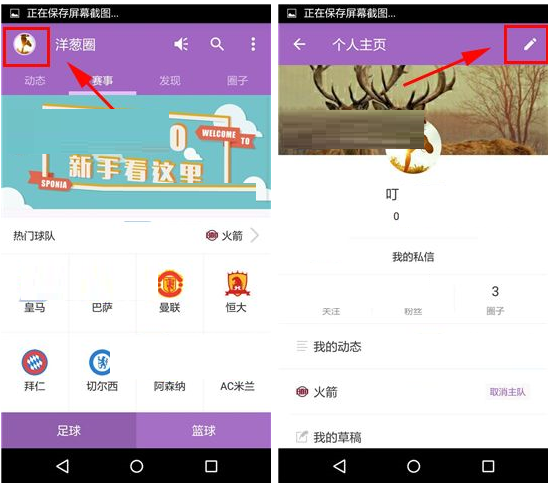 洋葱圈设置背景图方法